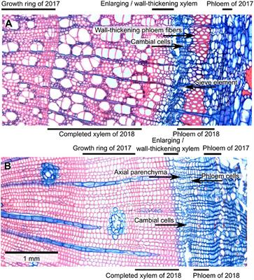 Seasonal Vascular Tissue Formation in Four Boreal Tree Species With a Focus on Callose Deposition in the Phloem